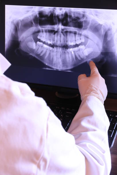 Best Emergency Treatment for Oral Infections in Linton Hall, VA
